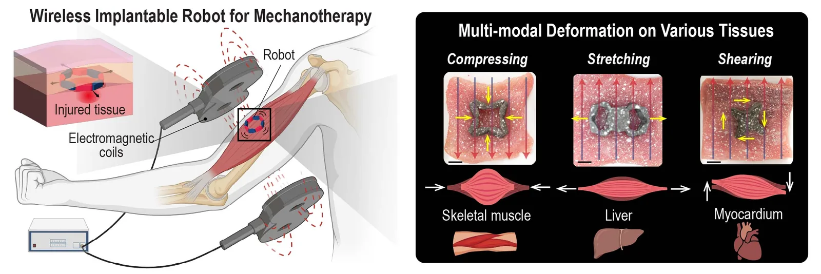 Wireless implantable soft robot for mechanotherapy.